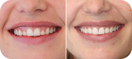 home smile gallery 1