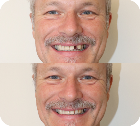 home smile gallery 2