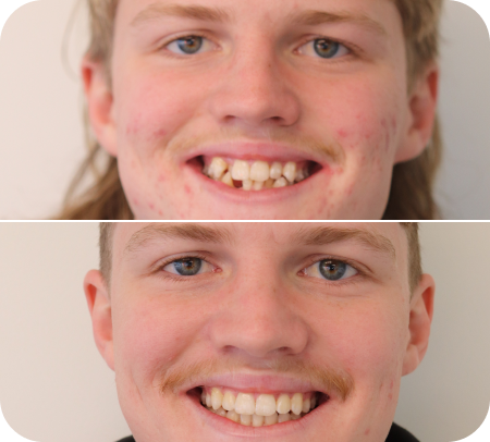 home smile gallery 3
