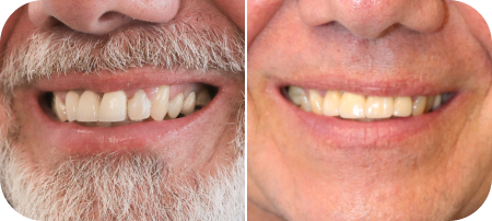 home smile gallery 4
