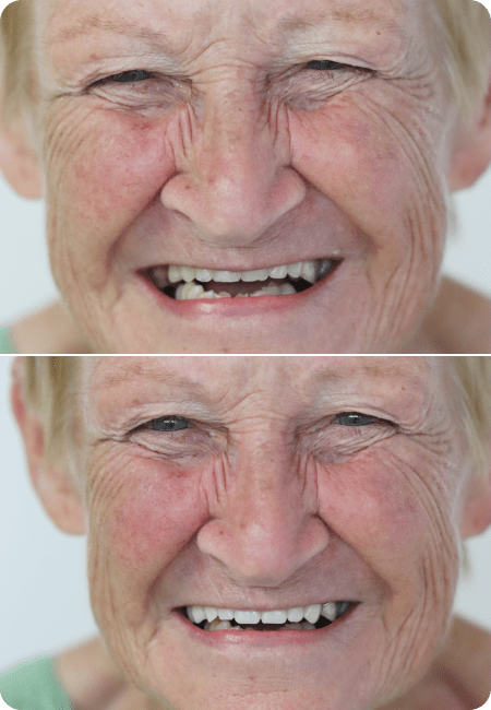 smile gallery 1 top