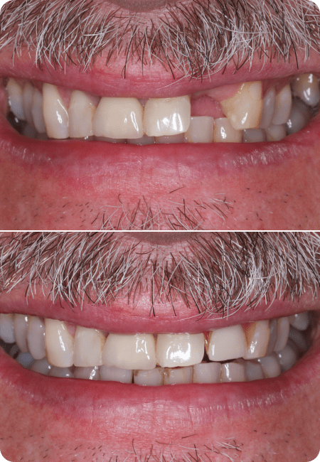 smile gallery 2 bottom
