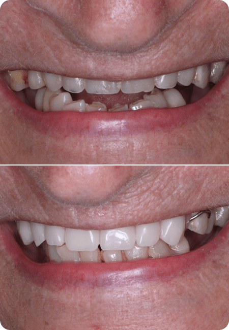 smile gallery 2 top