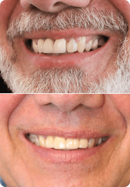 smile gallery 3 bottom