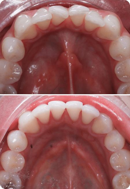 smile gallery 3 top