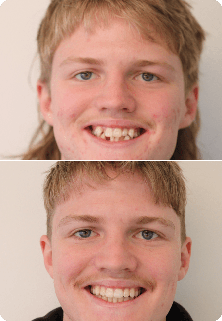 smile gallery 4 top