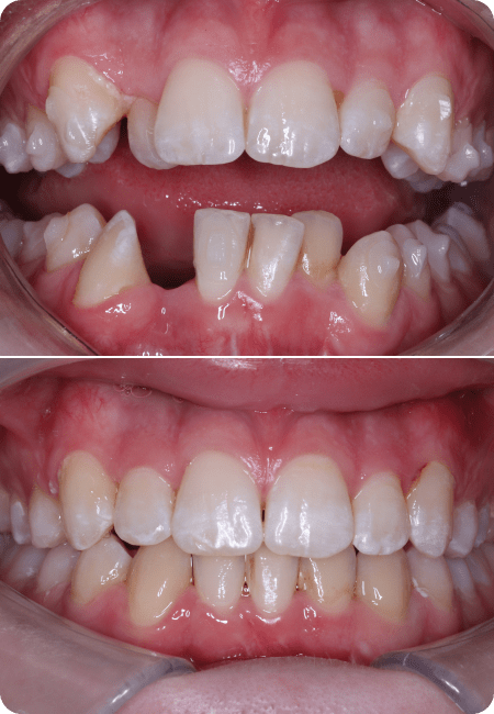smile gallery 5 top