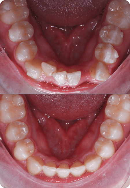 smile gallery 6 top