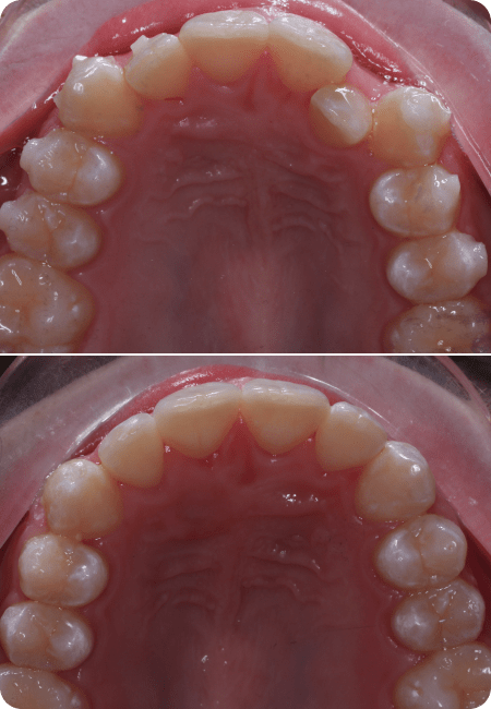 smile gallery 7 top