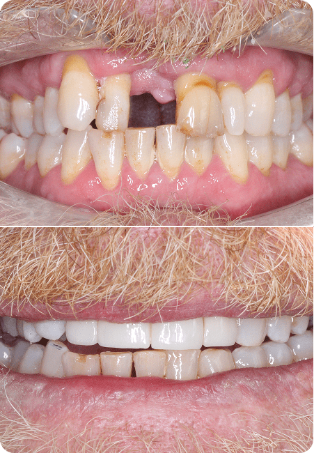new ba enso dental