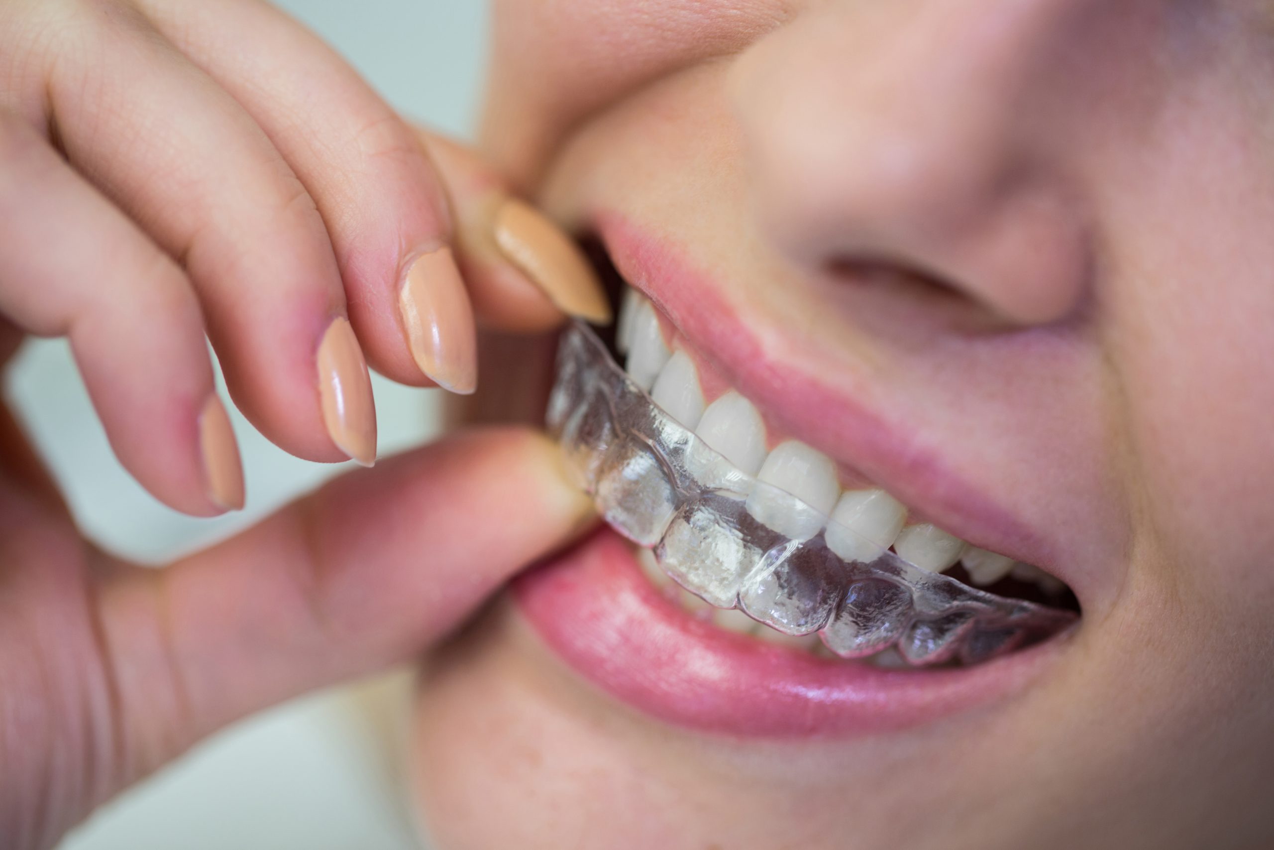 Enso Dental North Perth